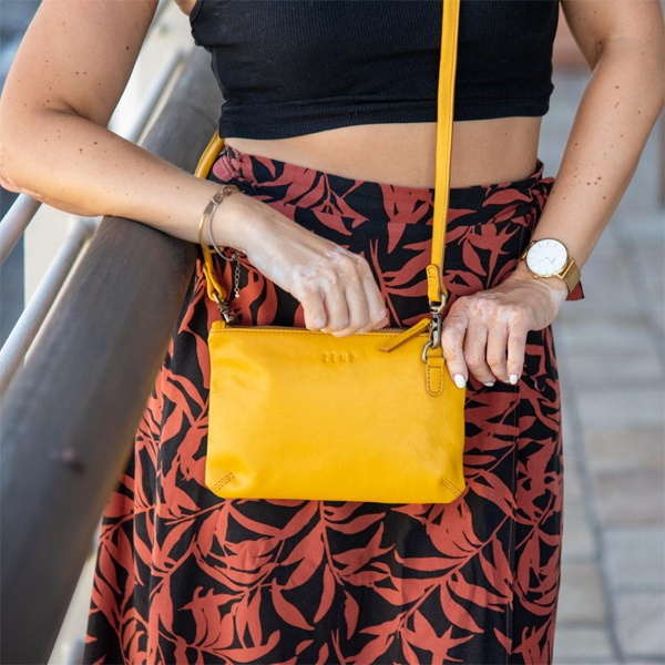 Person holding a yellow purse with a blurred background